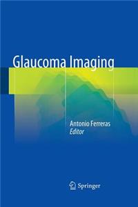 Glaucoma Imaging