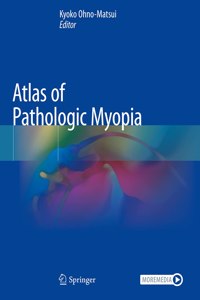 Atlas of Pathologic Myopia