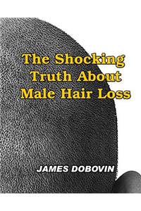 Shocking Truth About Male Hair Loss