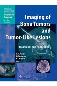 Imaging of Bone Tumors and Tumor-Like Lesions