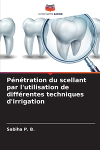 Pénétration du scellant par l'utilisation de différentes techniques d'irrigation