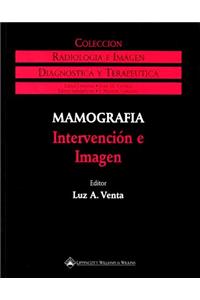 Mamografia