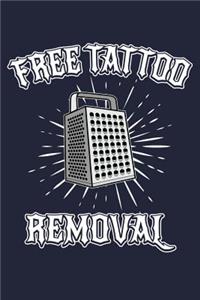 Free Tattoo Removal