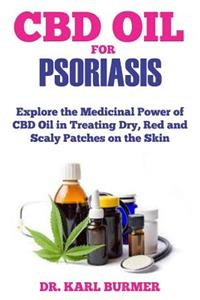 CBD Oil for Psoriasis