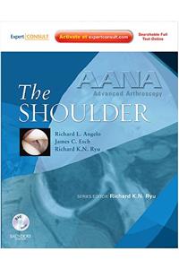 AANA Advanced Arthroscopy: The Shoulder
