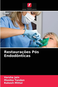 Restaurações Pós Endodônticas