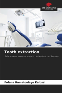 Tooth extraction