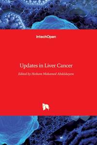 Updates in Liver Cancer