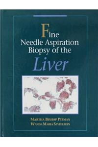 Fine Needle Aspiration Biopsy of the Liver