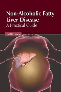 Non-Alcoholic Fatty Liver Disease: A Practical Guide