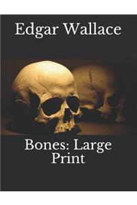 Bones: Large Print