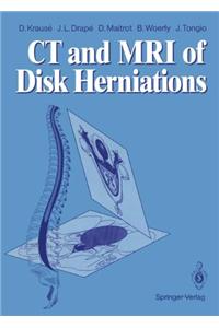 CT and MRI of Disk Herniations