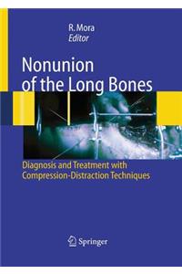 Nonunion of the Long Bones