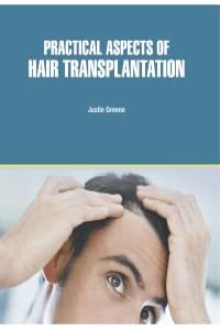 Practical Aspects Of Hair Transplantation