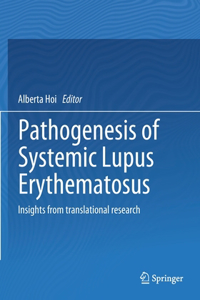 Pathogenesis of Systemic Lupus Erythematosus