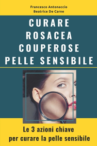 Curare Rosacea Couperose e Pelle Sensibile