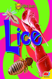 Lice