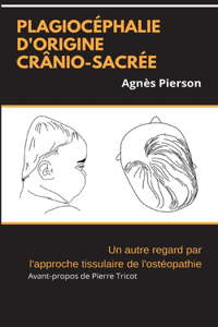 plagiocéphalie d'origine crânio-sacrée