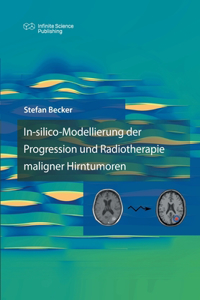 In-silico-Modellierung der Progression und Radiotherapie maligner Hirntumoren