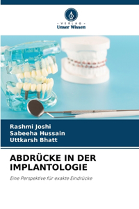 Abdrücke in Der Implantologie