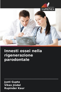 Innesti ossei nella rigenerazione parodontale