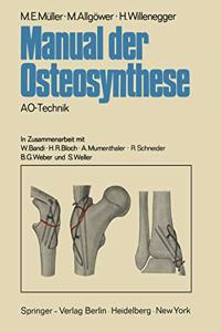 Manual Der Osteosynthese: Ao-Technik