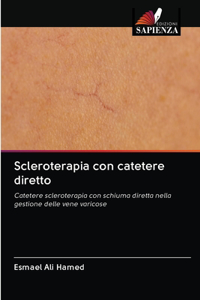 Scleroterapia con catetere diretto