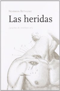 Las heridas