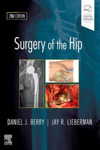 Surgery of the Hip