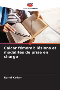 Calcar fémoral