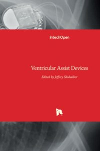 Ventricular Assist Devices