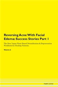 Reversing Acne With Facial Edema