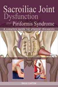 Sacroiliac Joint Dysfunction and Piriformis Syndrome