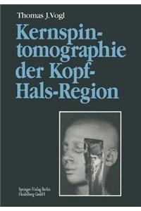 Kernspintomographie Der Kopf-Hals-Region
