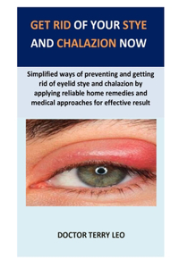 Get rid of your stye and chalazion now