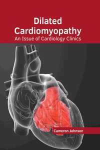Dilated Cardiomyopathy: An Issue of Cardiology Clinics