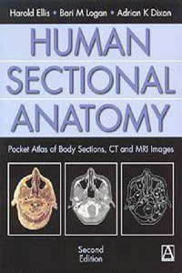 Human Sectional Anatomy, 2Ed: Pocket Atlas of Body Sections, CT and MRI Images