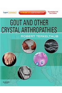 Gout and Other Crystal Arthropathies