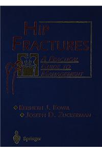 Hip Fractures A Practicle Guide to Management HB....