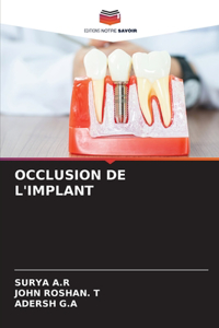 Occlusion de l'Implant