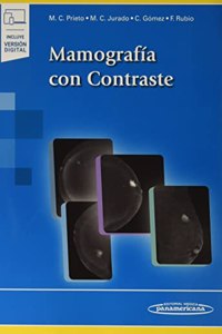 Mamografia con Contraste (+ebook)