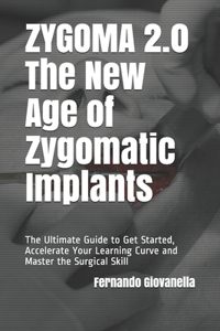ZYGOMA 2.0 - The New Age of Zygomatic Implants
