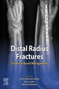 Distal Radius Fractures