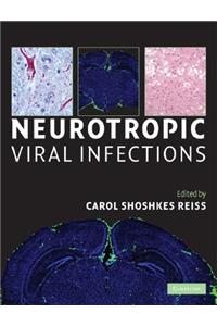 Neurotropic Viral Infections