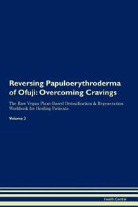 Reversing Papuloerythroderma of Ofuji