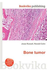 Bone Tumor