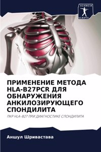 &#1055;&#1056;&#1048;&#1052;&#1045;&#1053;&#1045;&#1053;&#1048;&#1045; &#1052;&#1045;&#1058;&#1054;&#1044;&#1040; HLA-B27PCR &#1044;&#1051;&#1071; &#1054;&#1041;&#1053;&#1040;&#1056;&#1059;&#1046;&#1045;&#1053;&#1048;&#1071; &#1040;&#1053;&#1050;&#