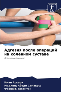 Адгезия после операций на коленном сустав