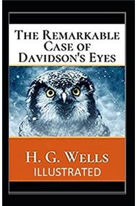 The Remarkable Case of Davidsons Eyes Illustrated