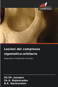 Lesioni del complesso zigomatico-orbitario